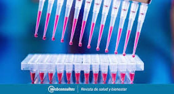 PCR