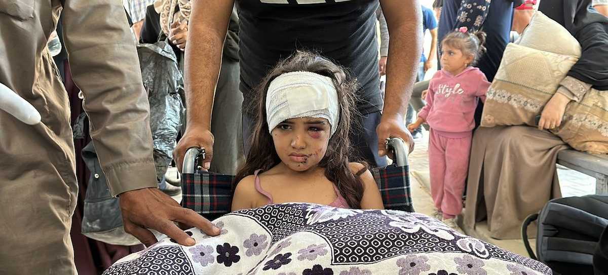 Una misión conjunta de la ONU en el norte de Gaza ayudó a trasladar a algunos pacientes, como esta niña, del Hospital Kamal Adwan al Hospital Al-Shifa. | Foto: OMS