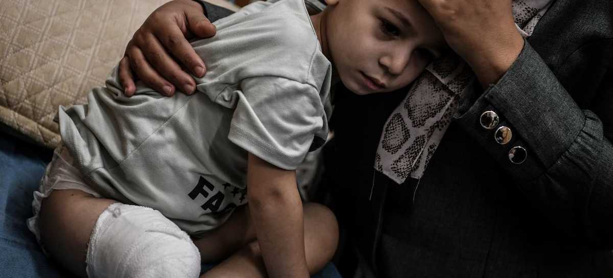 Los médicos decidieron amputar el pie a un niño de tres años en Jan Yunis, Gaza, debido a la escasez de recursos médicos. Otro tipo de violencia. | Foto: UNICEF/Abed Zaqout