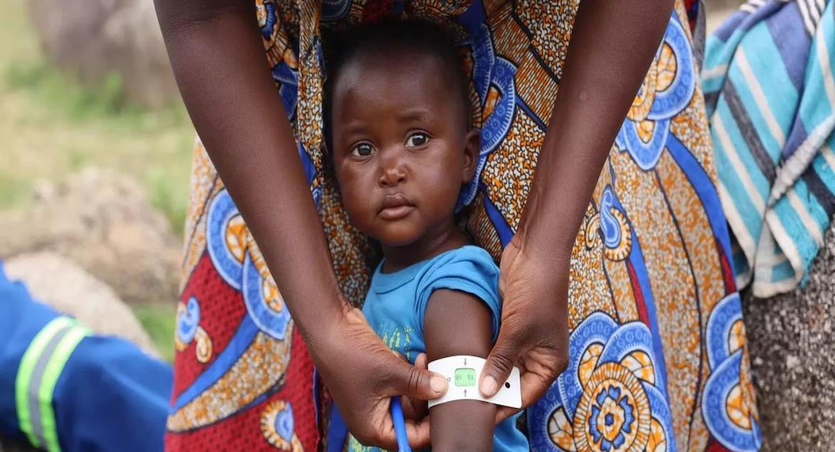 Un niño de Zimbabue es sometido a pruebas de desnutrición, en medio de los nuevos brotes de enfermedades. | Foto: UNICEF/Rutendo Bamhare