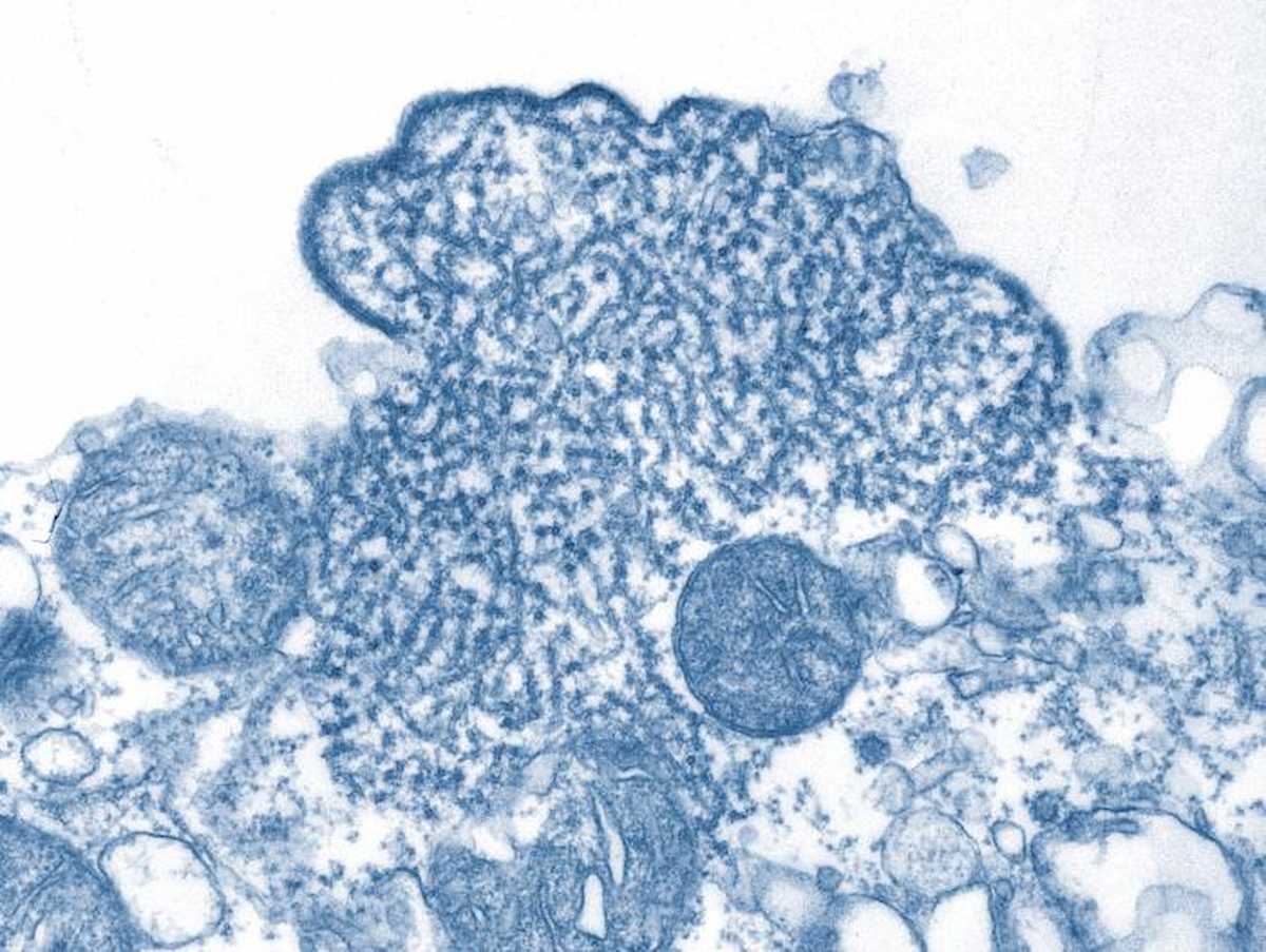 El virus Nipah al microscopio.