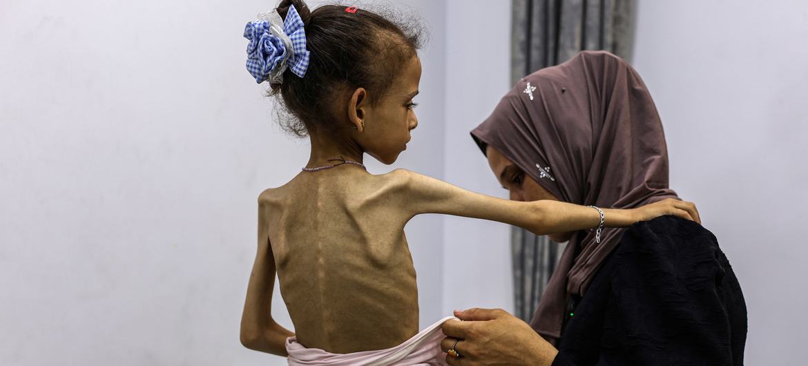 Gaza Hambruna Genocidio