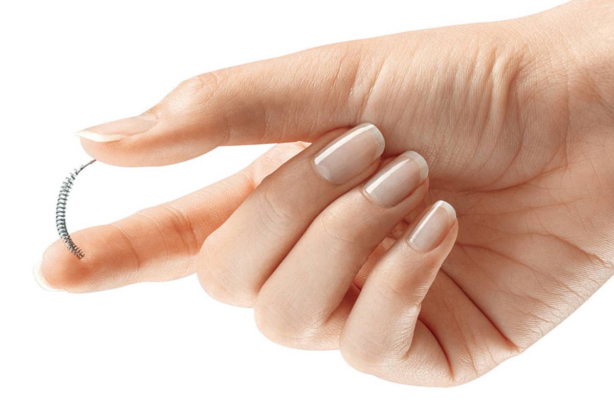 essure