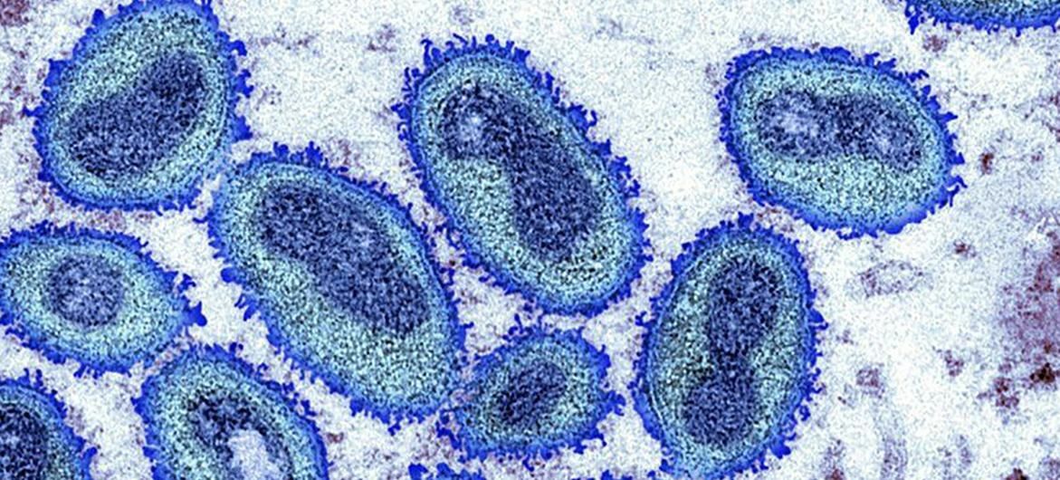 Imagen de microscopio del virus de la viruela del mono. Foto: CDC