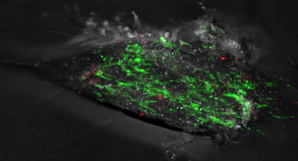 Imagen de un fibroblasto de paciente con enfermedad de Parkinson. Las mitocondrias aparecen en color verde. Fragmentos de mitocondrias dañadas en rojo. IIBB-CSIC