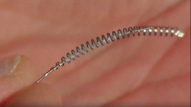 Essure